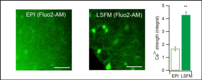 Imaging of calcium signal in astrocytes in acute mouse brain slices