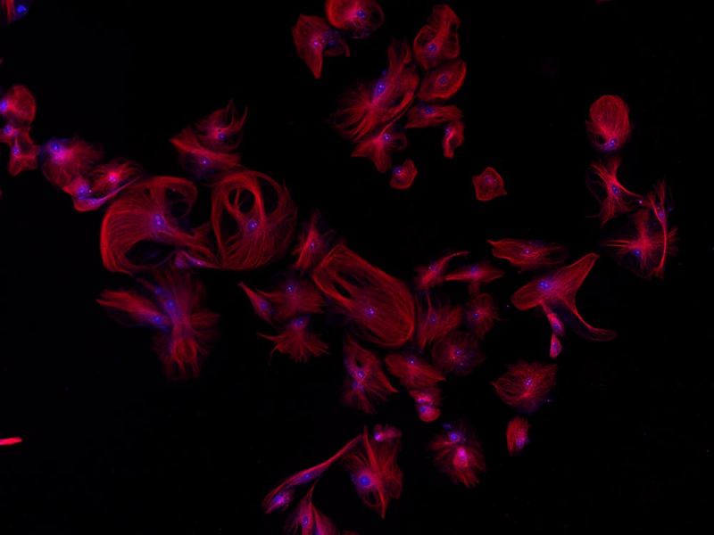 Tubulin und Zellkern von BSC-1-Zellen
