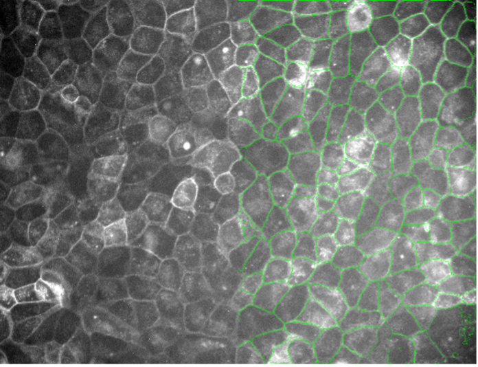 Deep learning image segmentation of plant cells