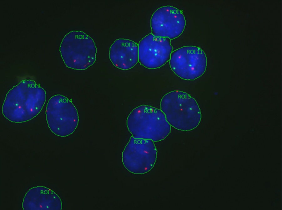 イメージングソフトウェアcellSens Dimensionパッケージのカウントアンドメジャー機能における、関心領域として輪郭が示された青色の核および赤色と緑色のオブジェクトの顕微鏡画像の取得