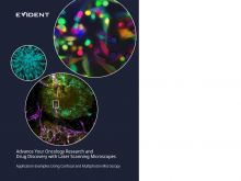 Advance Your Oncology Research and Drug Discovery with Laser Scanning Microscopes: Application Examples Using Confocal and Multiphoton Microscopy