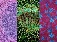 Seeing Shapes—Our Most Popular Microscope Images for May 2022