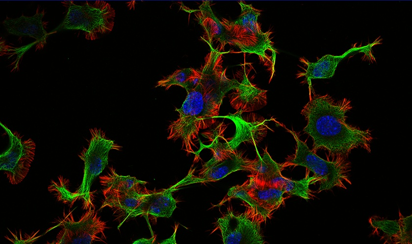 Imagerie de fluorescence de cellules vivantes